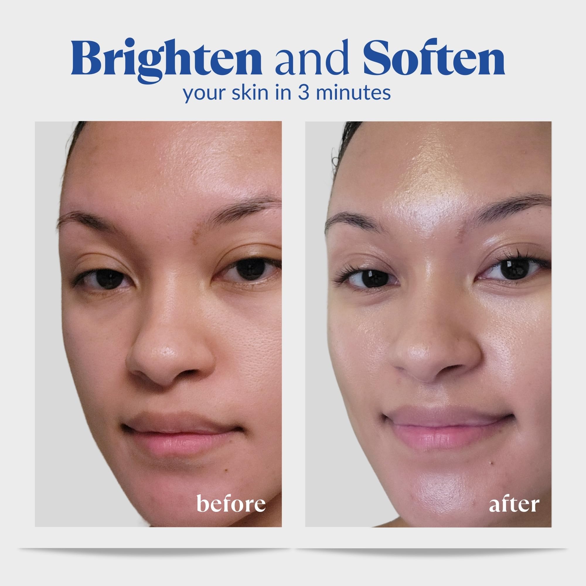 Natural Aqua Gel Cure dermatologist-approved formula for sensitive skin.