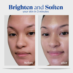 Natural Aqua Gel Cure dermatologist-approved formula for sensitive skin.