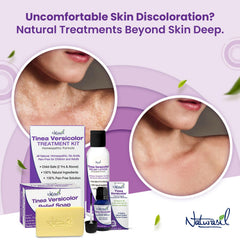 Naturasil Tinea Versicolor Soap closeup texture highlights micronized sulfur and botanicals.