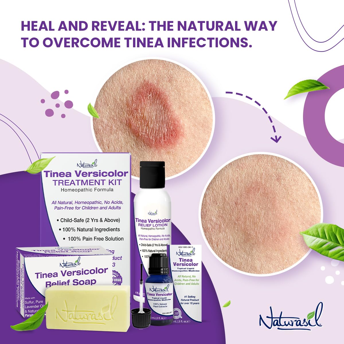 Naturasil Tinea Versicolor USA-made badge on packaging.