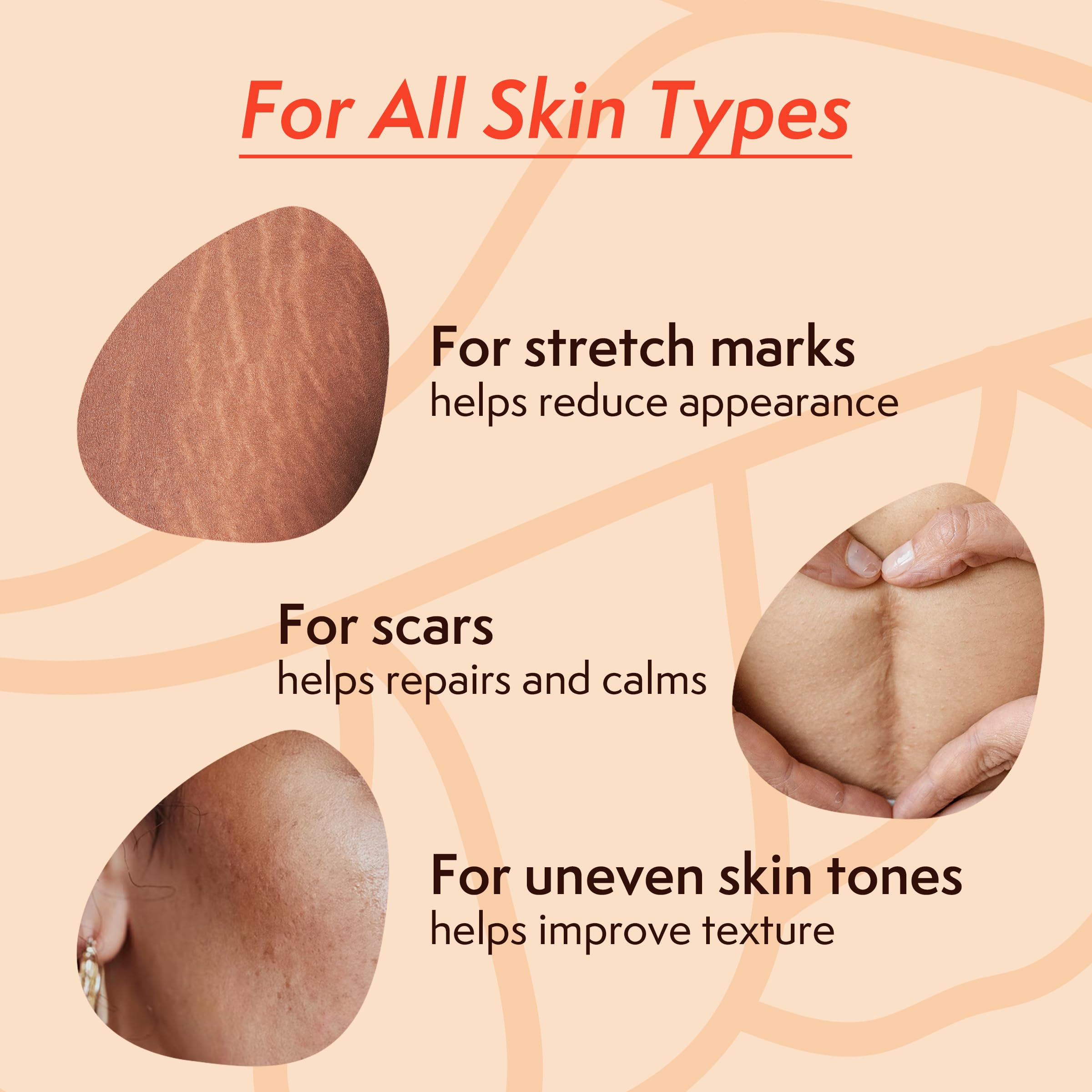 Nature Spell Stretch Mark Oil texture swirl showing rich hydrating formula