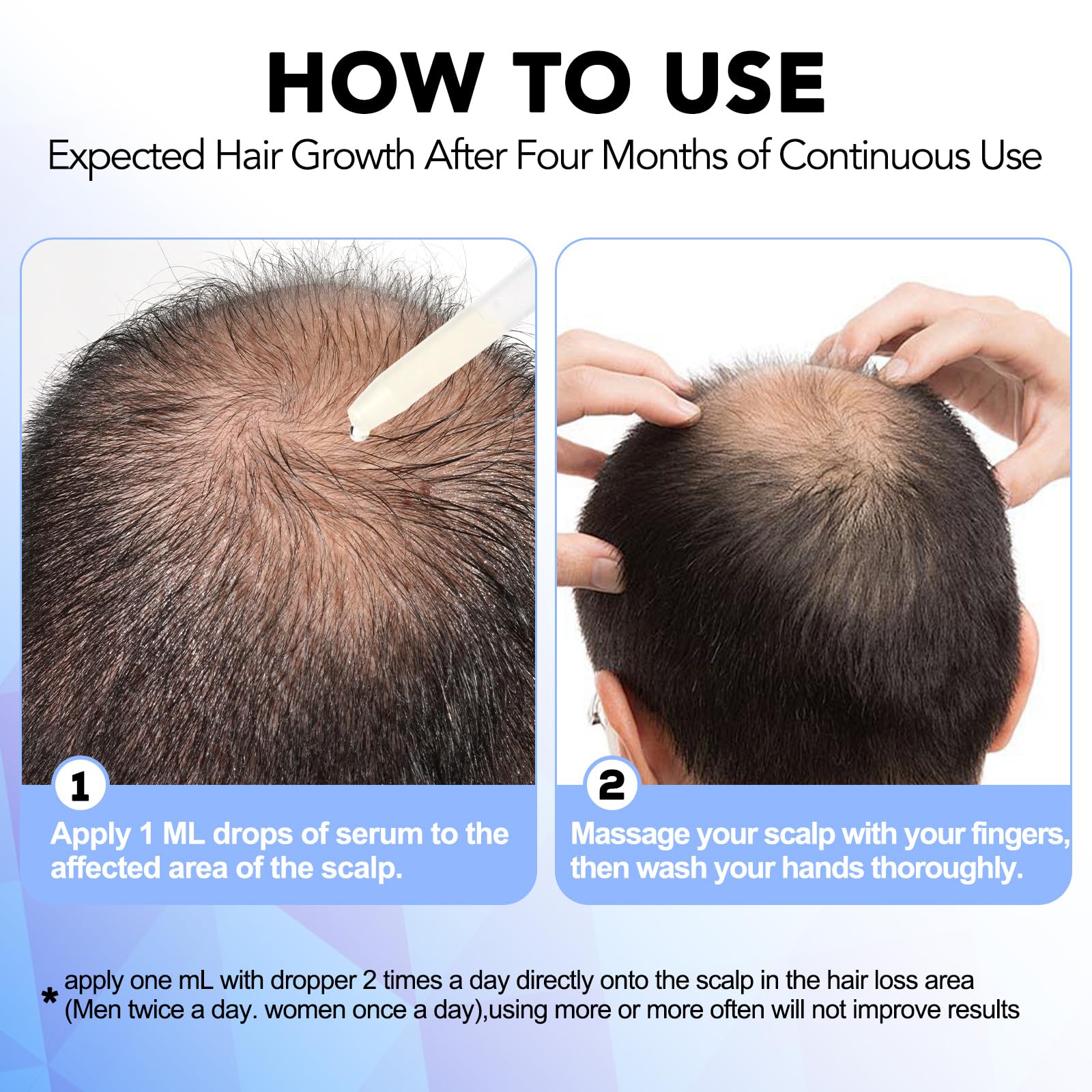 Nature Ziran Minoxidil for men and women in use.