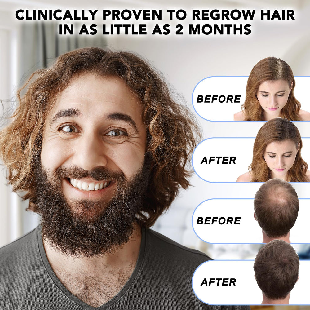 Nature Ziran Minoxidil scalp-massage image demonstrates effective application.