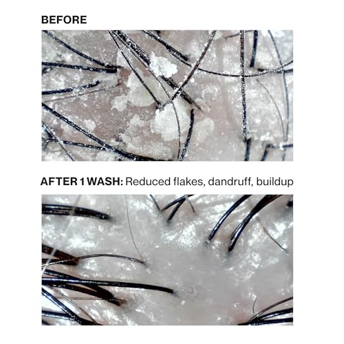 NatureLab.TOKYO Hyaluronic acid depiction highlights deep hydration for dry hair