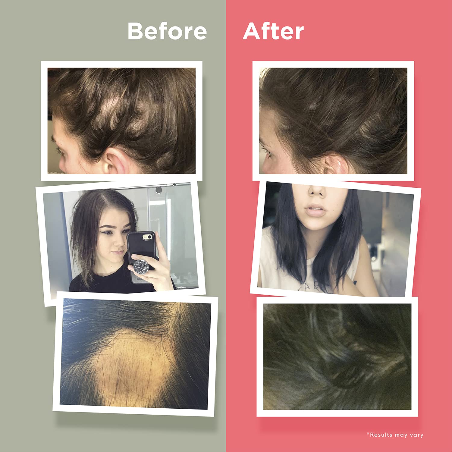 Naturenetics HairAnew packaging with nutrition facts for transparency