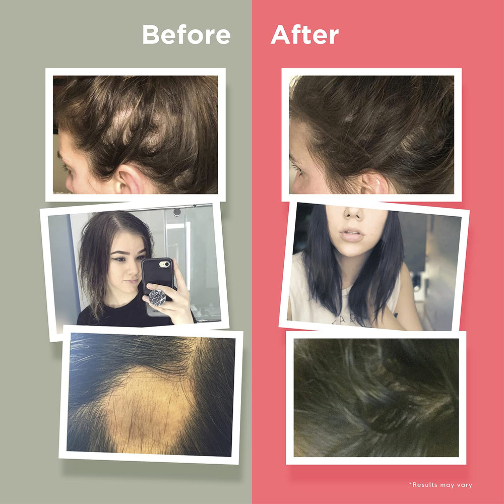 Naturenetics HairAnew packaging with nutrition facts for transparency