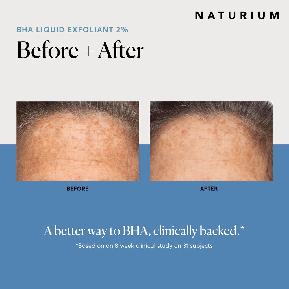 Close-up texture of Naturium BHA liquid exfoliant on skin
