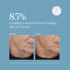 Naturium Retinol Complex Serum bakuchiol plant-derived option for sensitive skin
