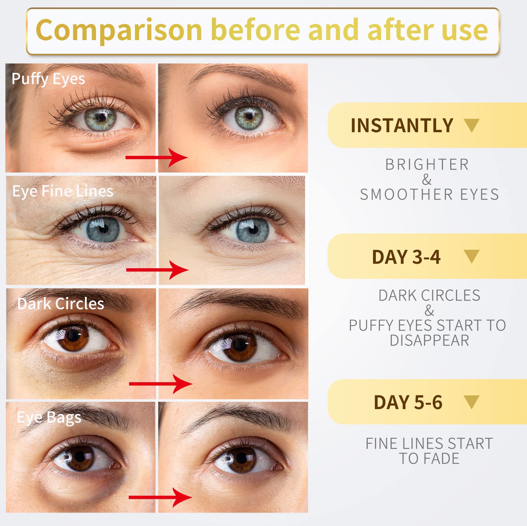 NAZANO under-eye patches with hyaluronic acid and collagen promote hydration.