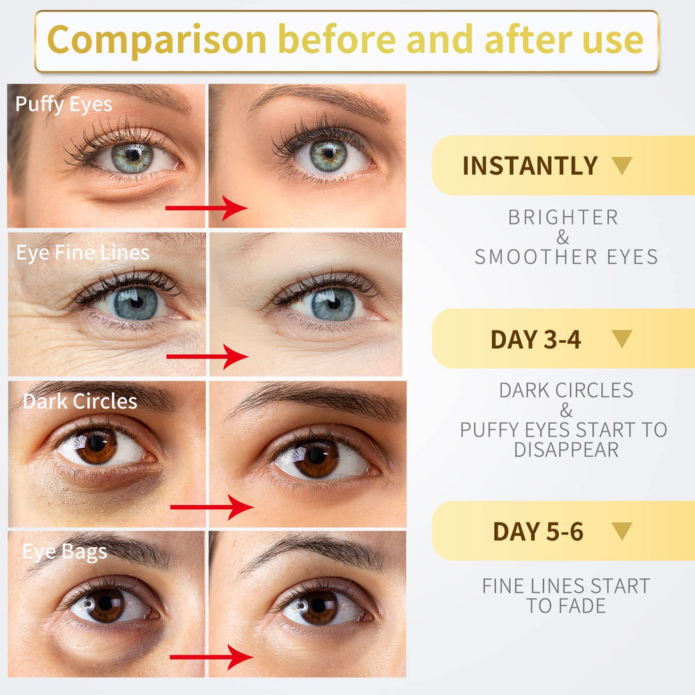 NAZANO under-eye patches with hyaluronic acid and collagen promote hydration.