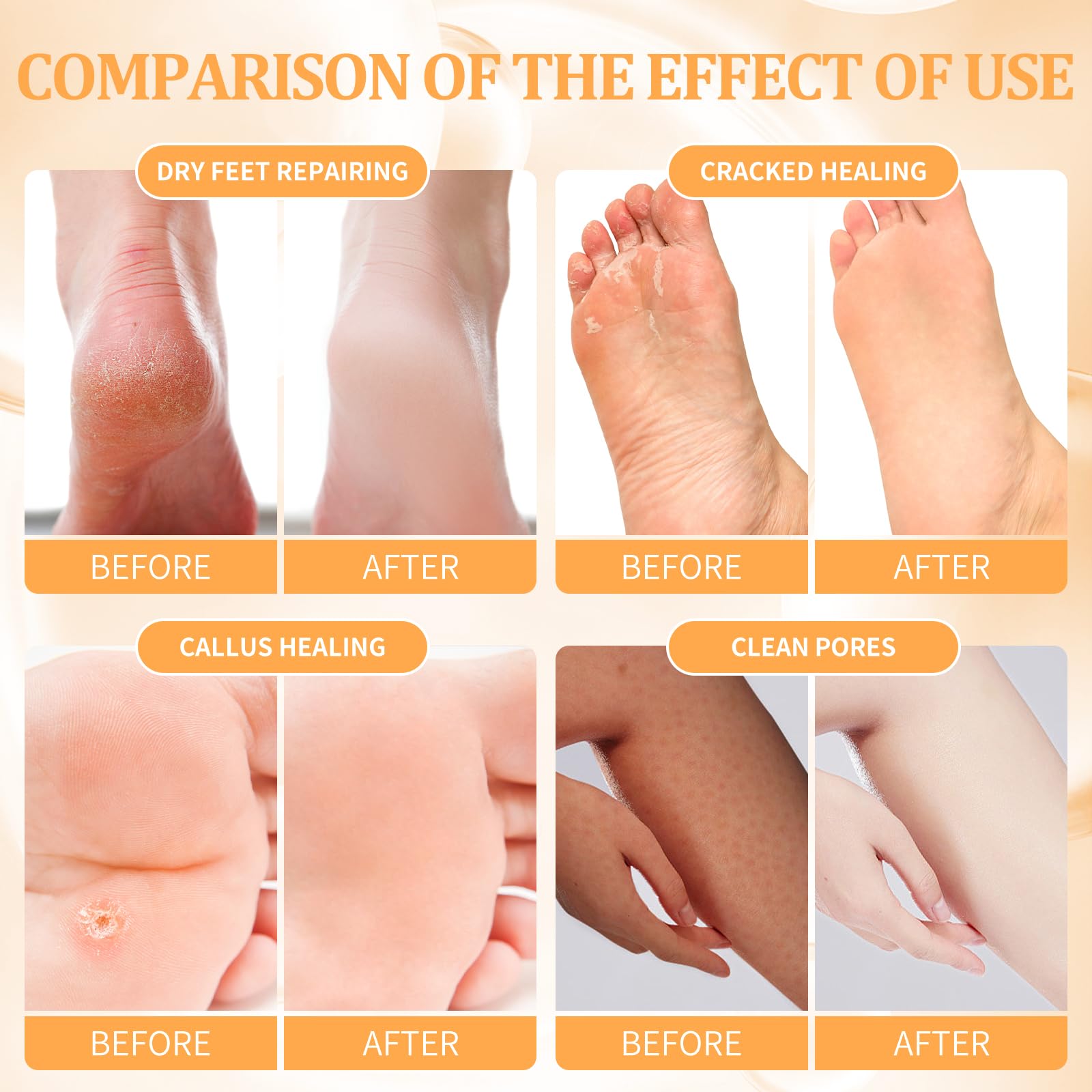 nbc BeautiLab pedicure kit massage mask application promoting relaxation and foot care