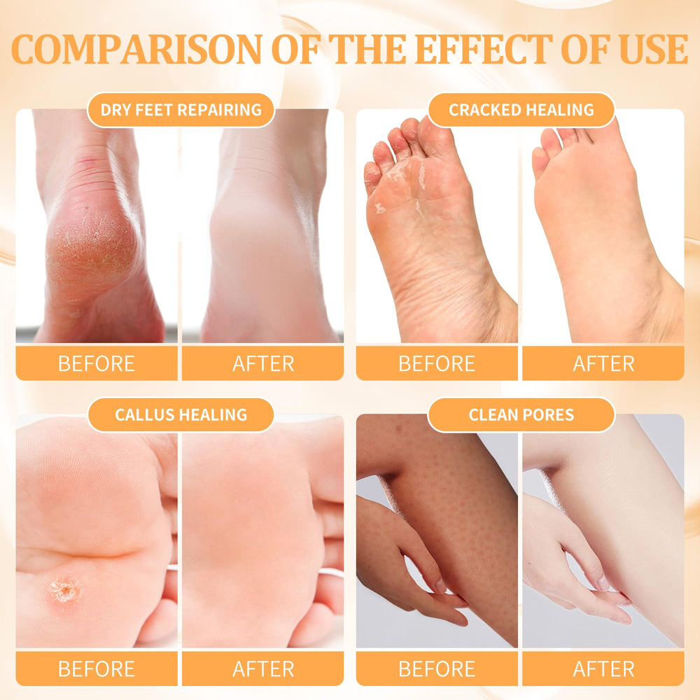 nbc BeautiLab pedicure kit massage mask application promoting relaxation and foot care