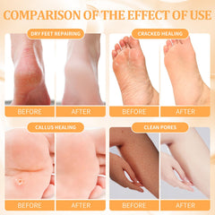 nbc BeautiLab pedicure kit massage mask application promoting relaxation and foot care