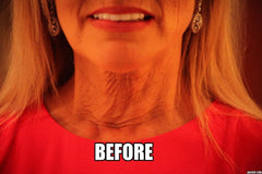 NeckTITE Magic adhesion-stretch-enhanced-material improves comfort and wear time.