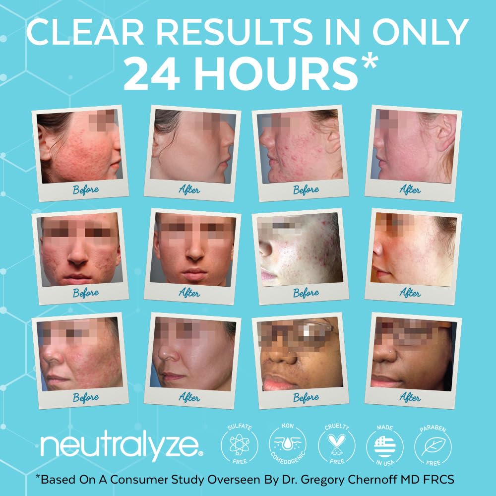 Neutralyze Exfoliating Toner Pads used on face and body in routine
