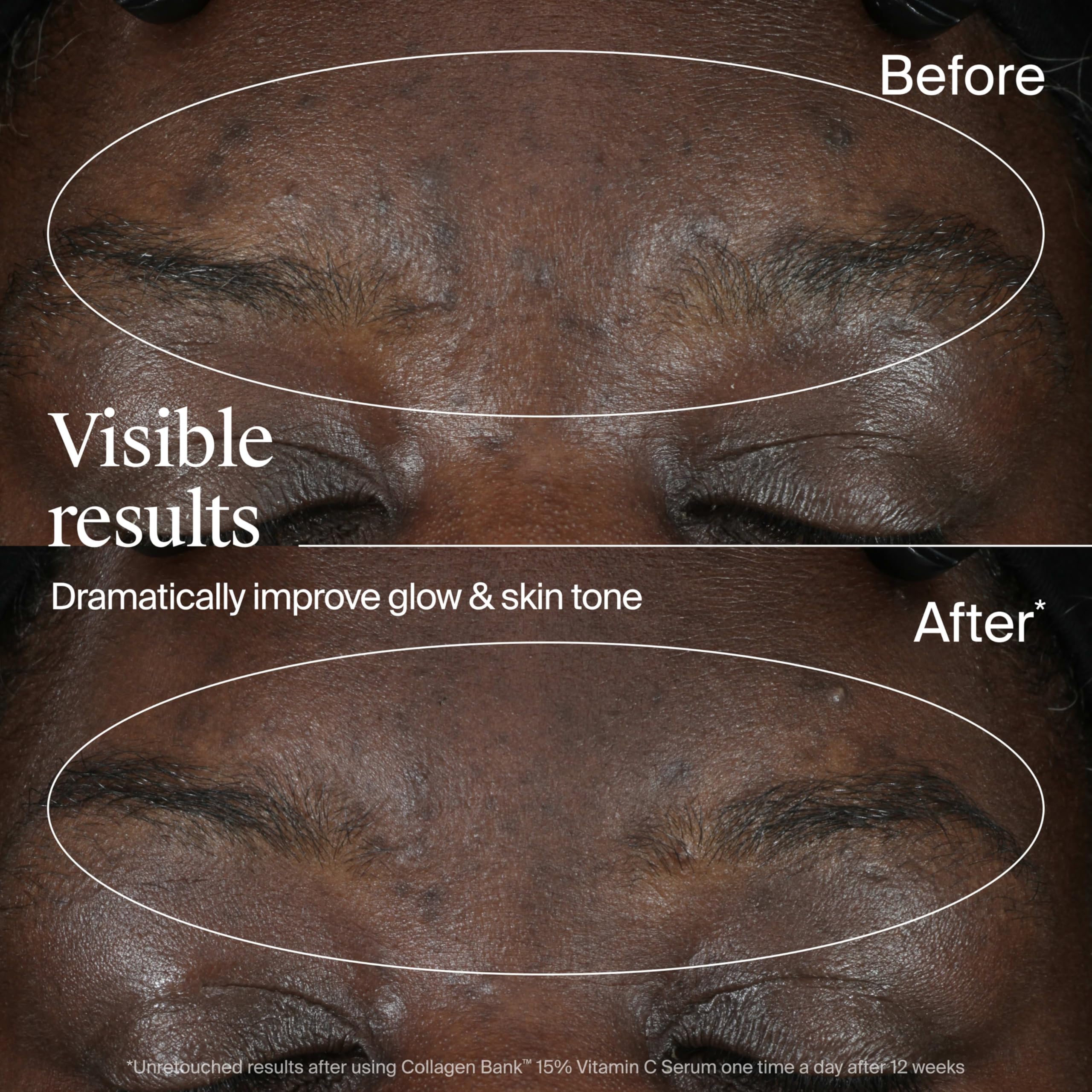 Neutrogena Collagen Bank vitamin C serum may help even skin tone.
