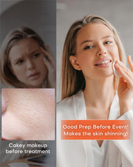 NEWKEY 150 LED chips provide strong, even light for skin benefits