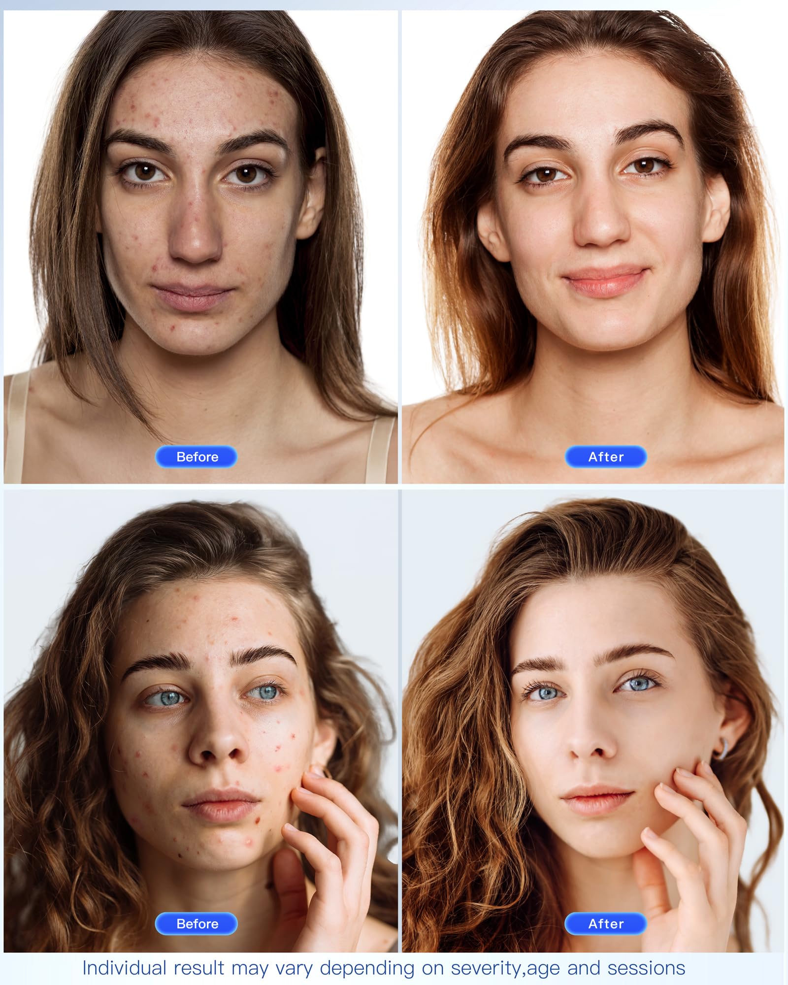 NEWKEY LED Face Mask worn full view for an at home skincare routine