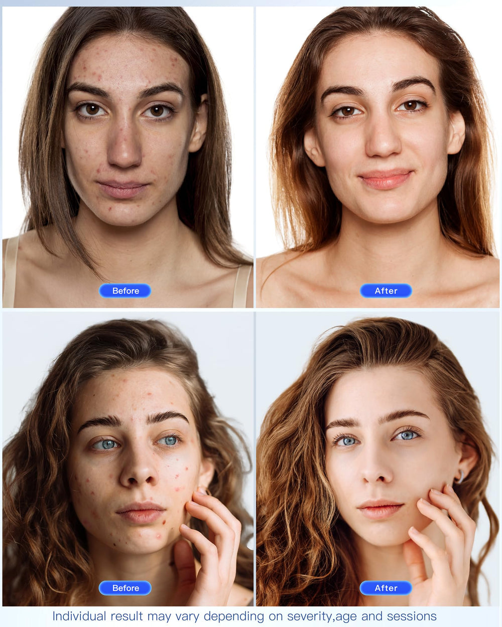 NEWKEY LED Face Mask worn full view for an at home skincare routine