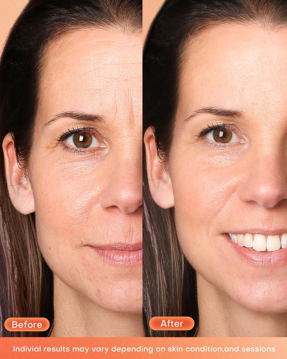 NEWKEY LED mask complete coverage delivers uniform light across facial areas