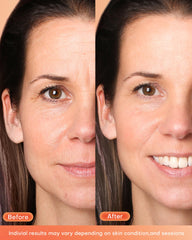 NEWKEY LED mask complete coverage delivers uniform light across facial areas
