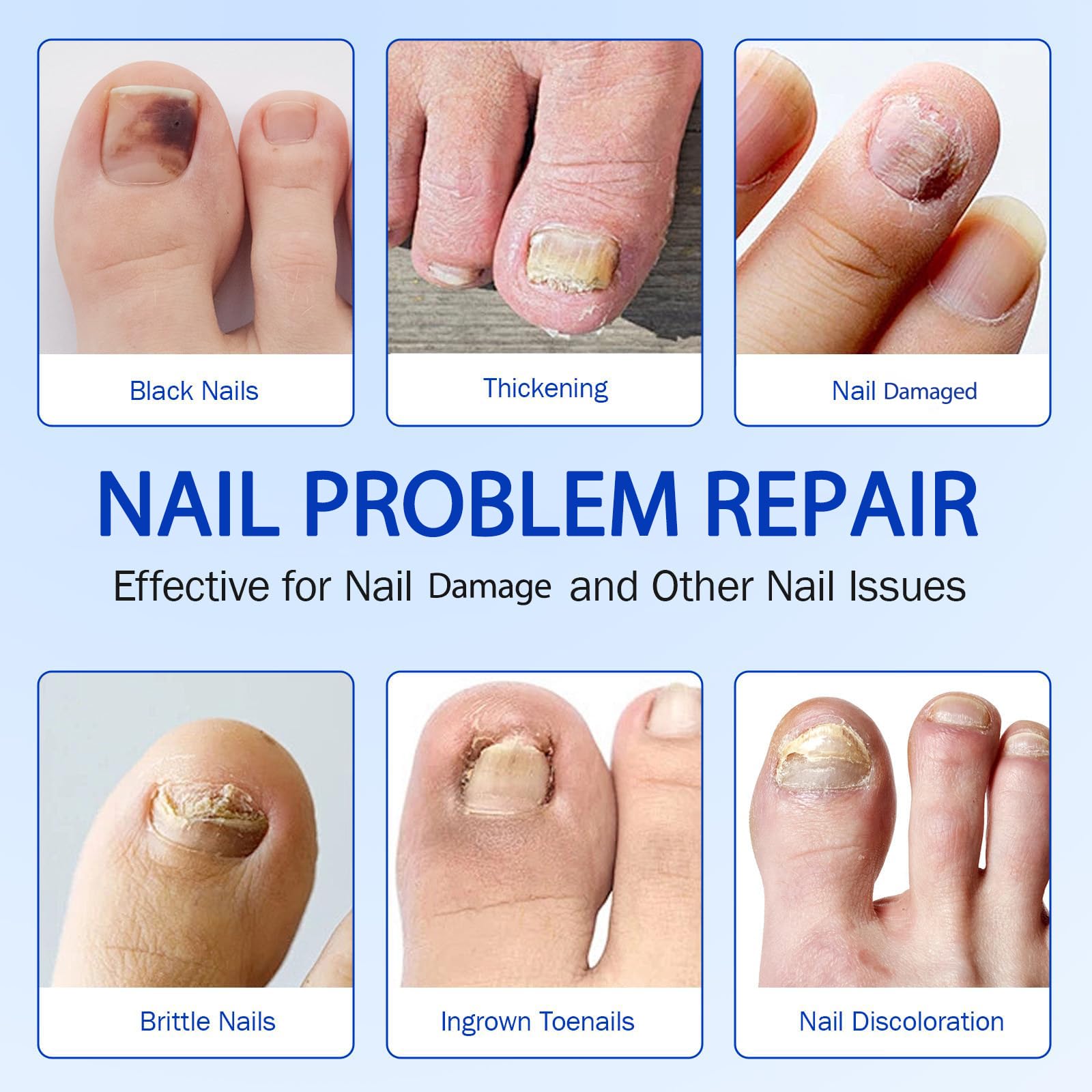 Nichalous Nail Patches hydrogel close-up highlights breathable adhesive.