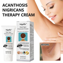 Nigrifix-knees-elbows-dark-spot targets rough patches for refined texture.