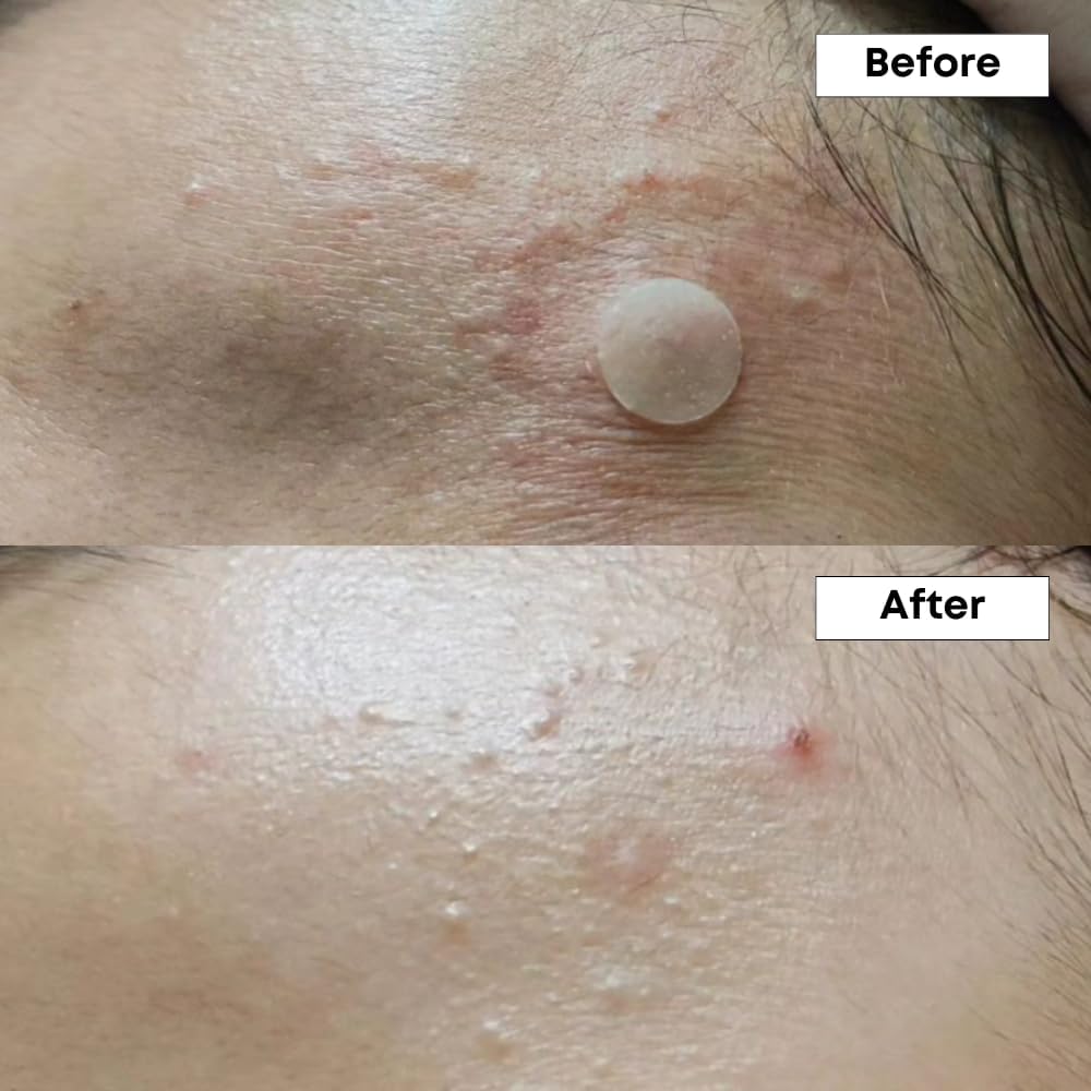 NINELESS A-Control routine steps illustrate an easy skincare ritual.