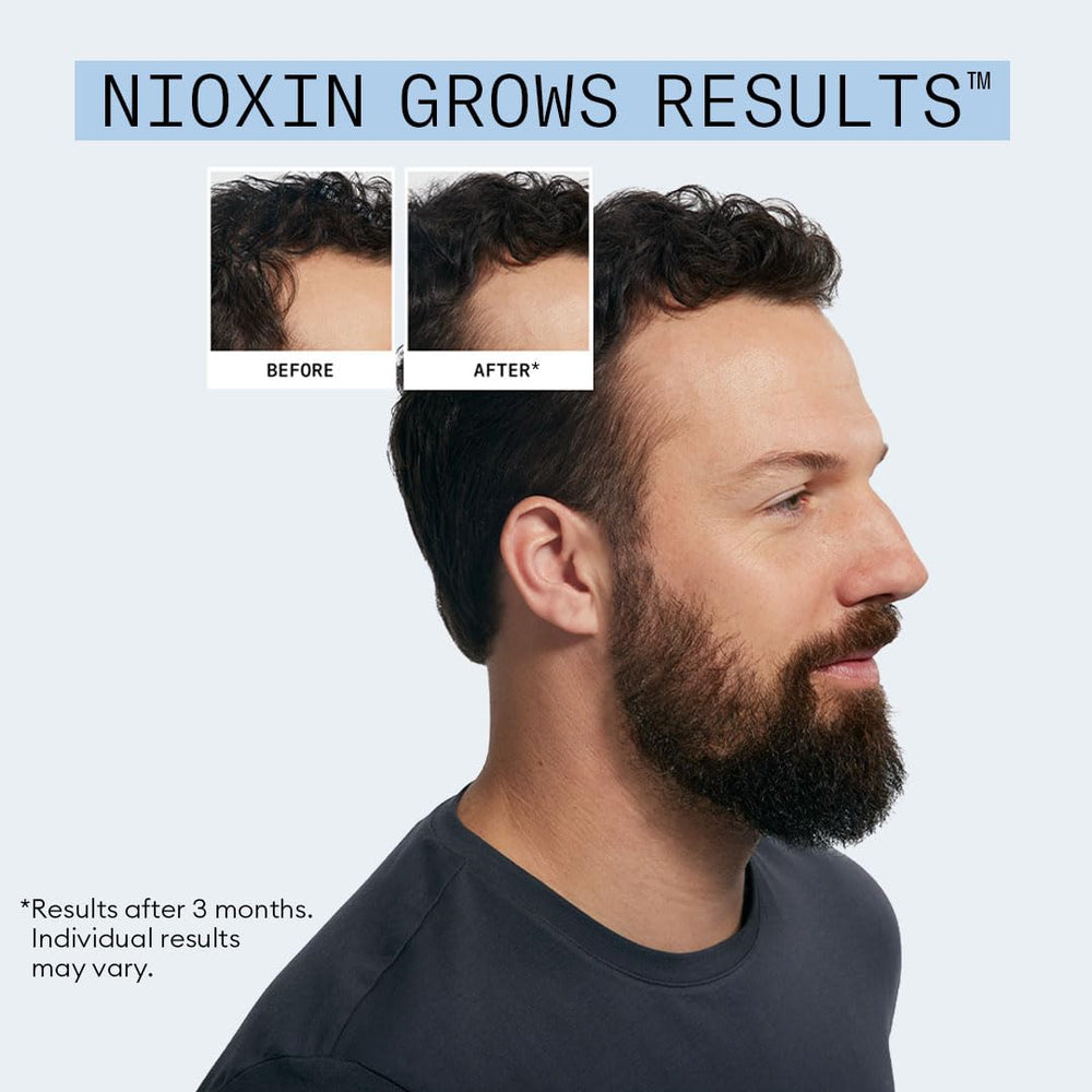 Nioxin applying serum to scalp illustrating daily anchoring support