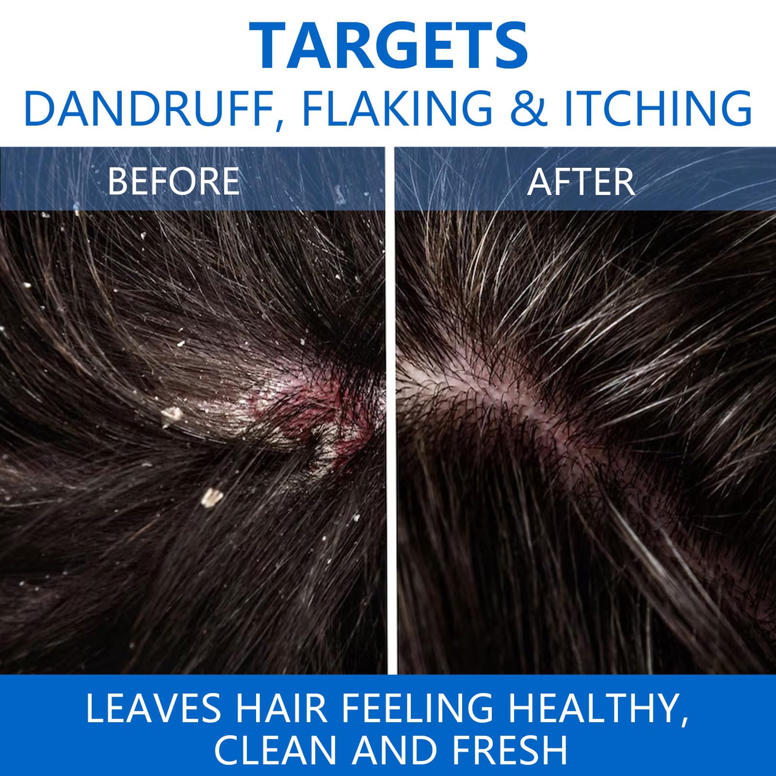NIPPORI scalp-refresh application captures a calming cleansing ritual for the scalp.