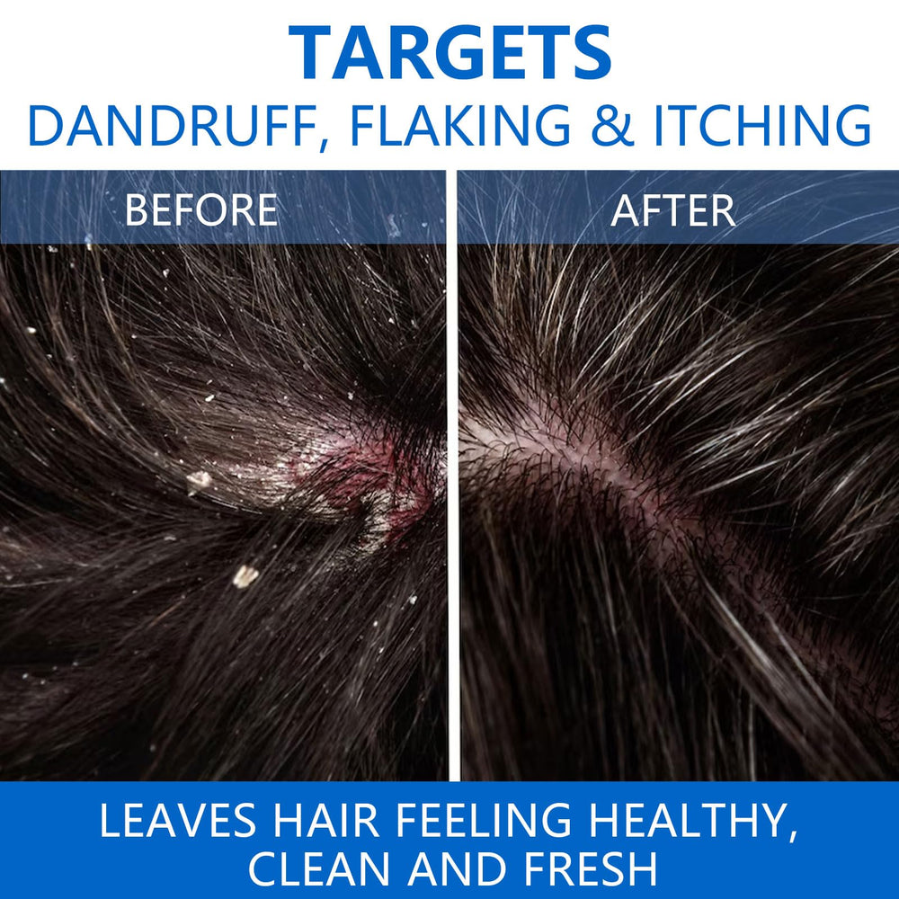 NIPPORI scalp-refresh application captures a calming cleansing ritual for the scalp.