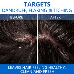 NIPPORI scalp-refresh application captures a calming cleansing ritual for the scalp.