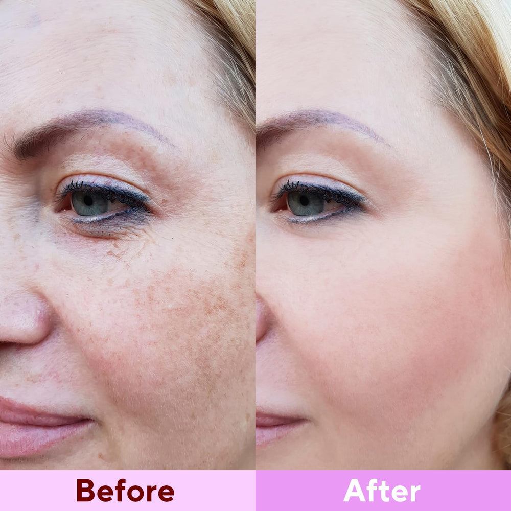 Nityrliv Bio-Collagen Real Deep Mask hydrogel texture close-up highlights gentle serum delivery.