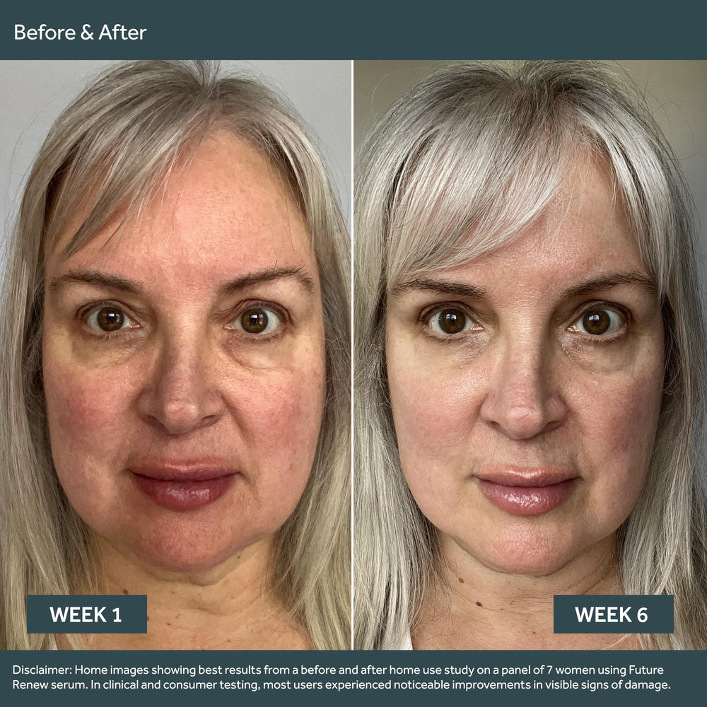 No7 Future Renew serum on skin promoting brighter, even-toned appearance.