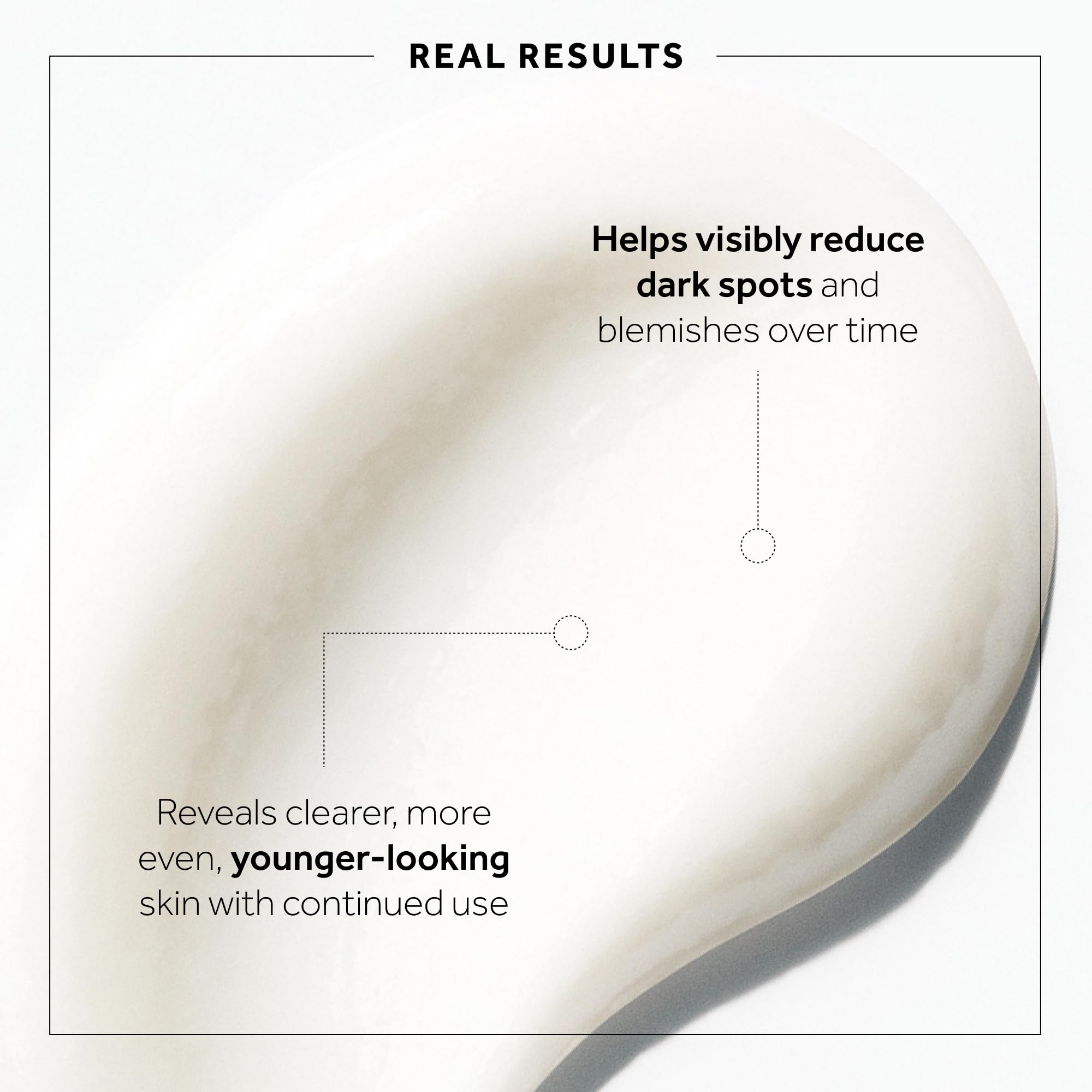 No7 Microdermabrasion Total Renewal application image demonstrates gentle circular massage for at-home renewal.