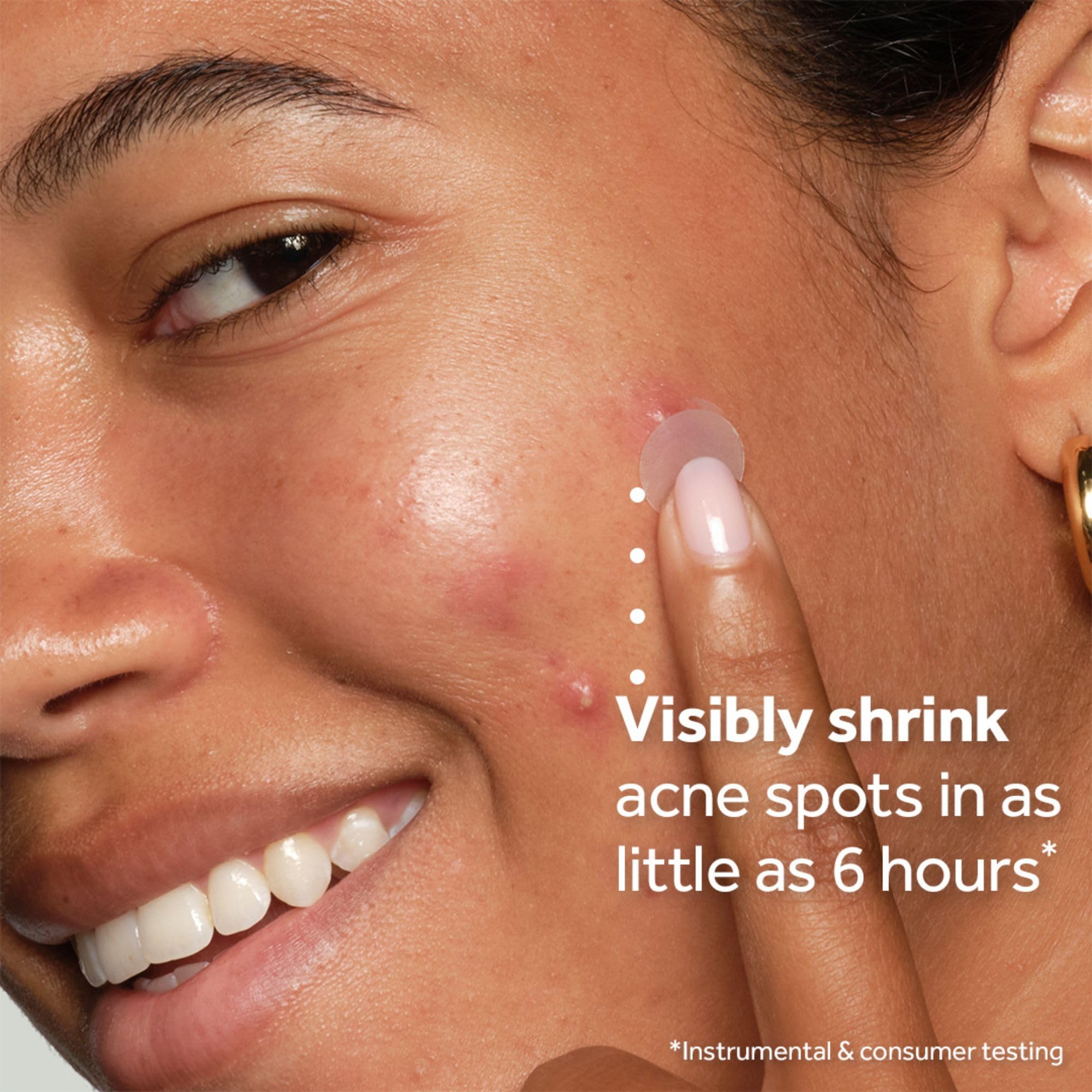 No7 patches displayed in four sizes to fit different blemishes and needs