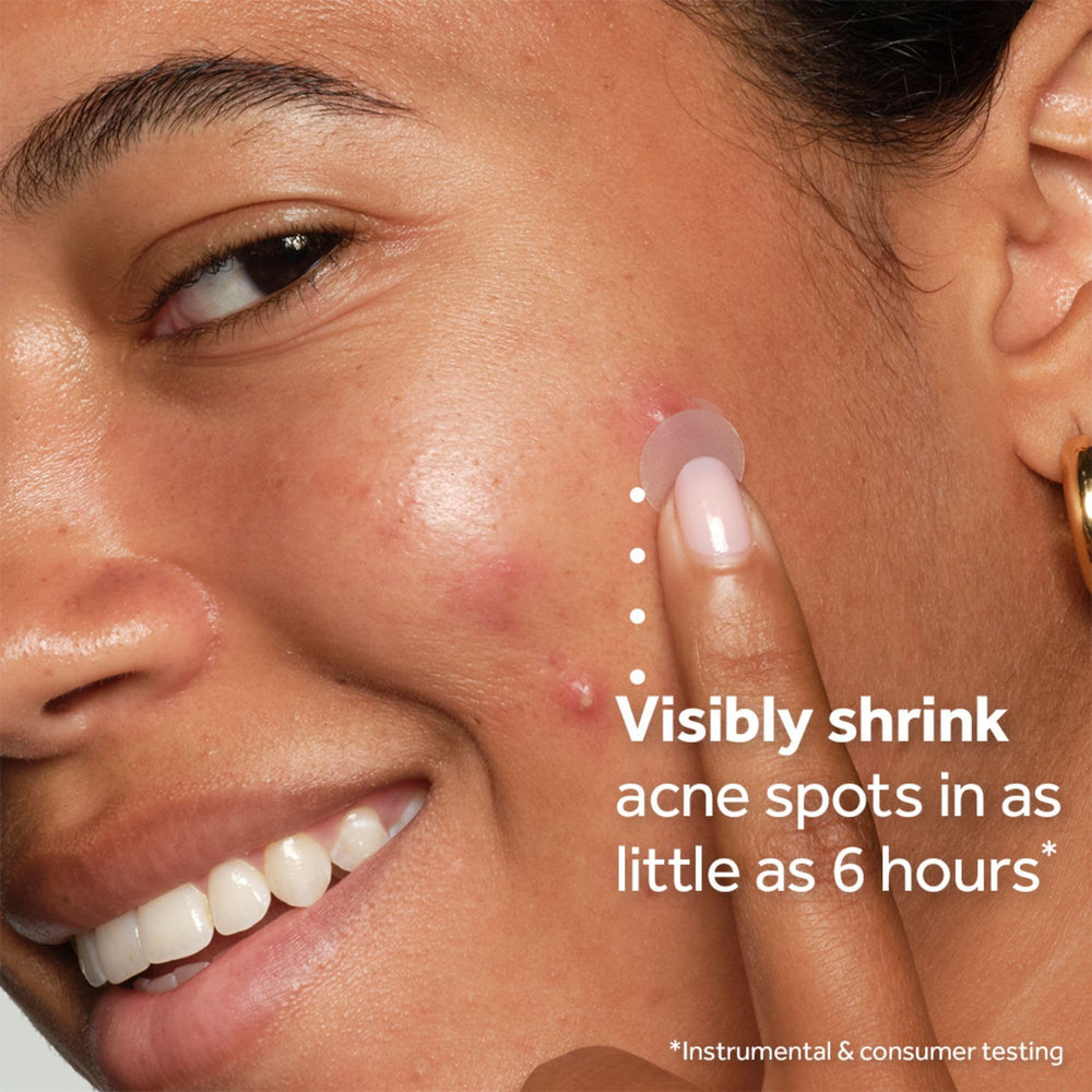 No7 patches displayed in four sizes to fit different blemishes and needs