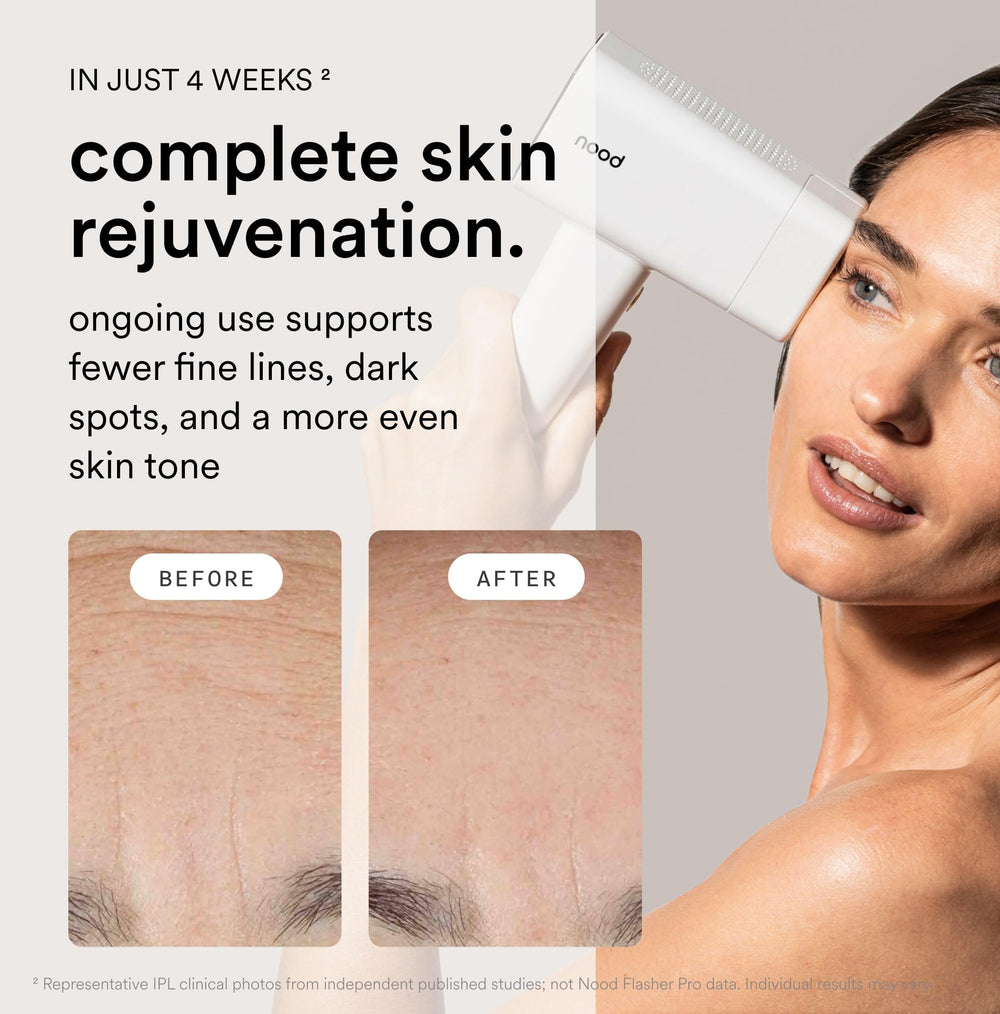 Nood Flasher Pro ageless lens swap enables anti-aging skin benefits