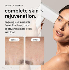Nood Flasher Pro ageless lens swap enables anti-aging skin benefits