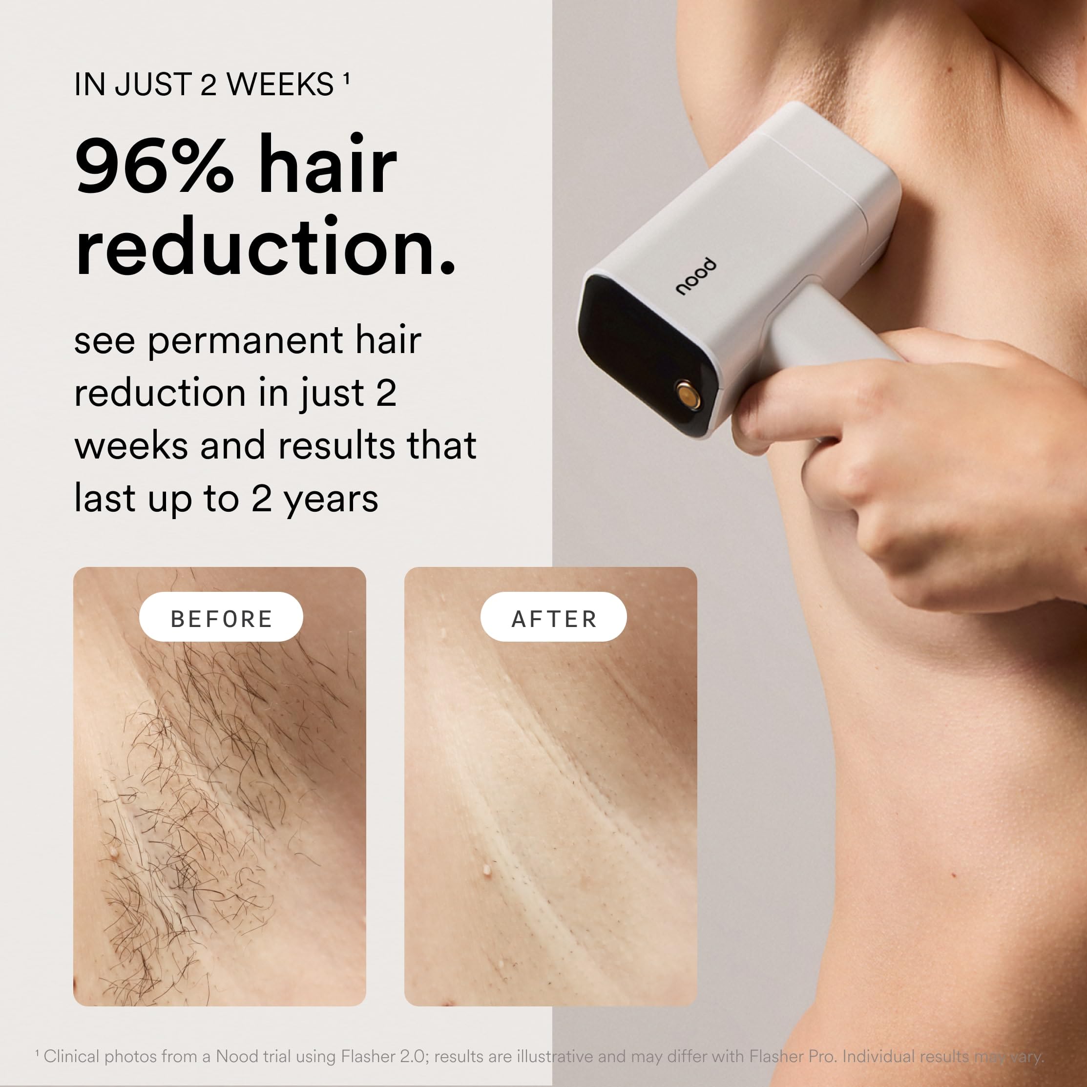 Nood Flasher Pro anti-aging lens for firmer-looking skin