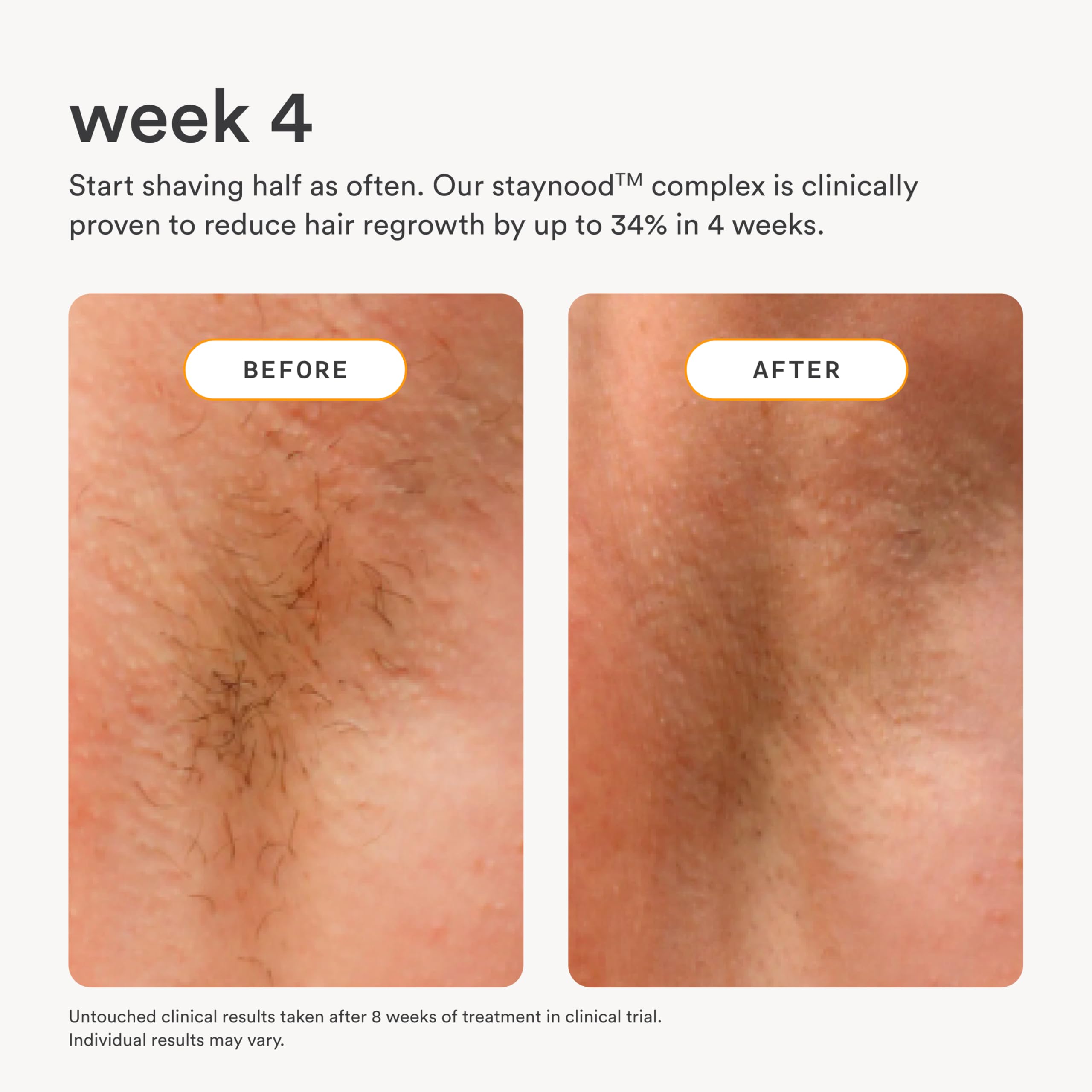 Nood Serum ideal for underarms, bikini line, and legs.