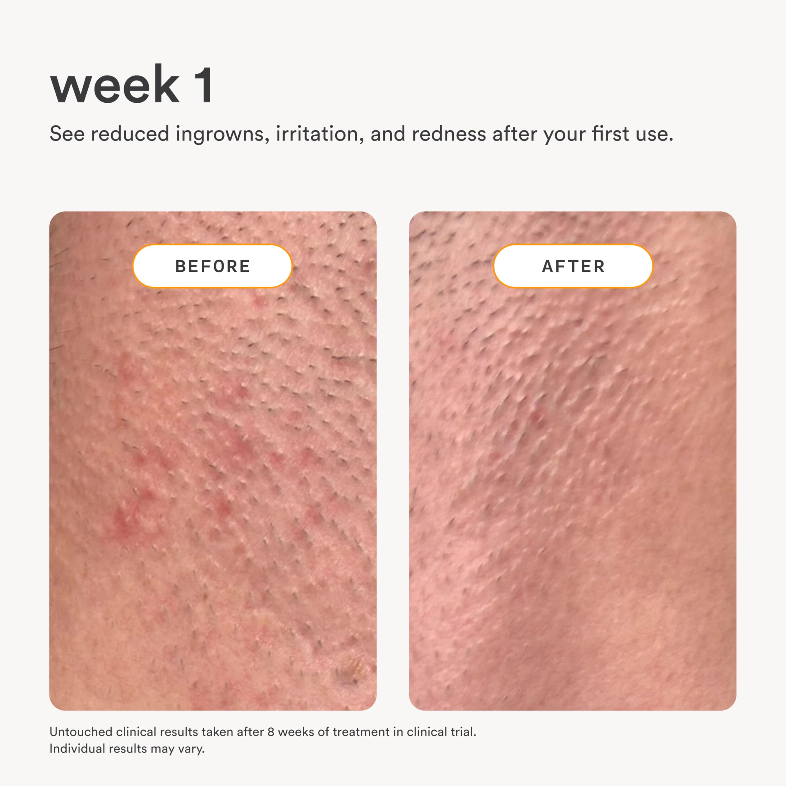 Nood Serum on leg skin showing reduced irritation and smoother texture.