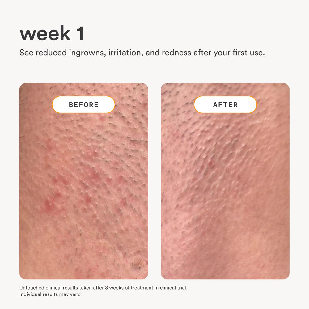 Nood Serum on leg skin showing reduced irritation and smoother texture.