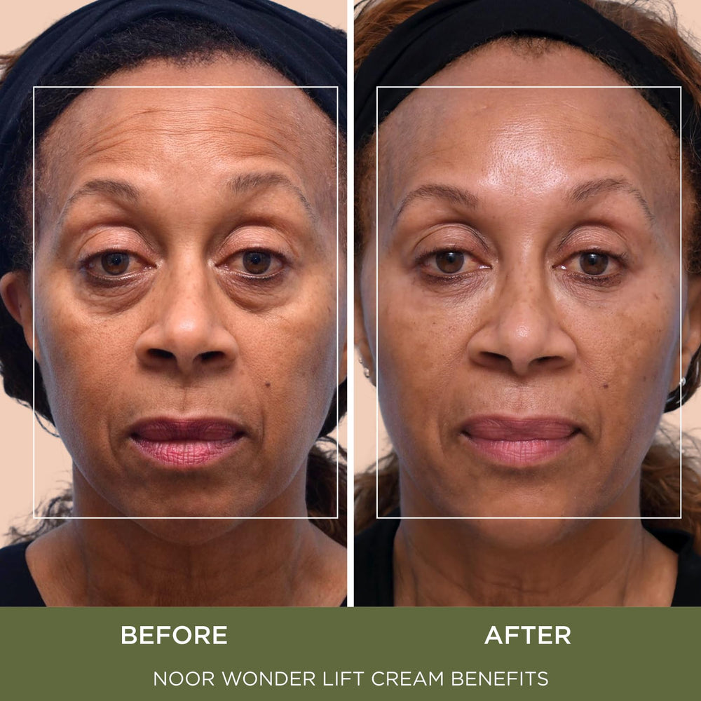 Noor Wonder Lift Cream applied to face demonstrates easy gentle blending for daily rituals