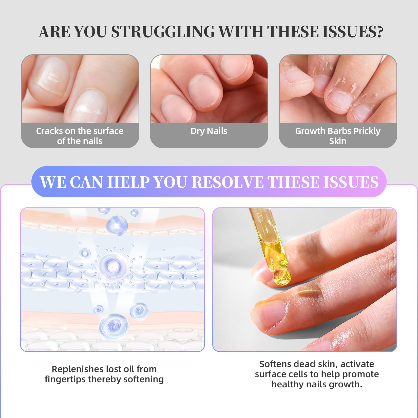 NORCICO gel-polish-remover-15ml lifts gel in minutes with a gentle formula.