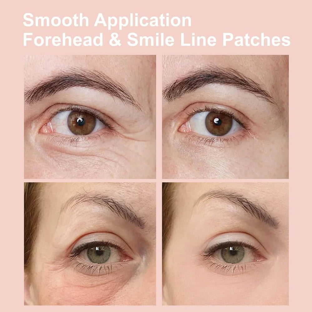 NOVALIFT Kunnozz contour-fit patches designed for secure wear around the eye area.