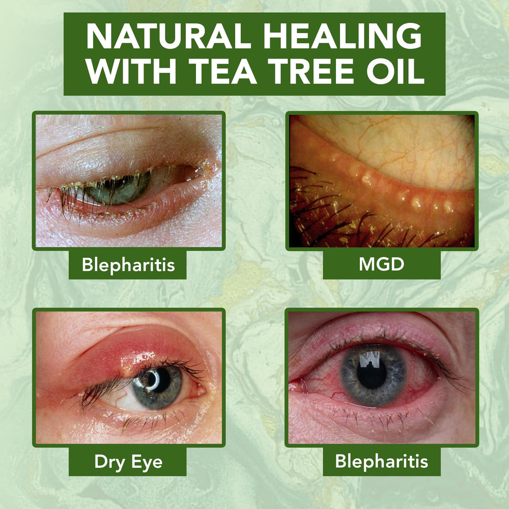NOVEHA Tea Tree con B5 y E: ingredientes para soporte de elasticidad.