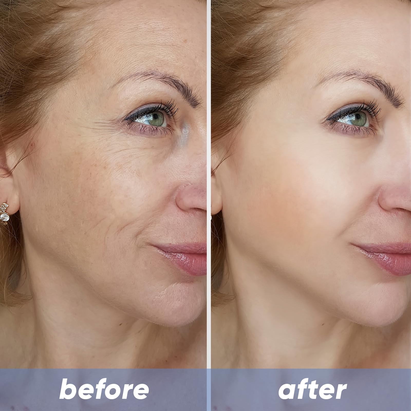 NOVIQO hydrating serum bottle close-up showing deep hydration potential.
