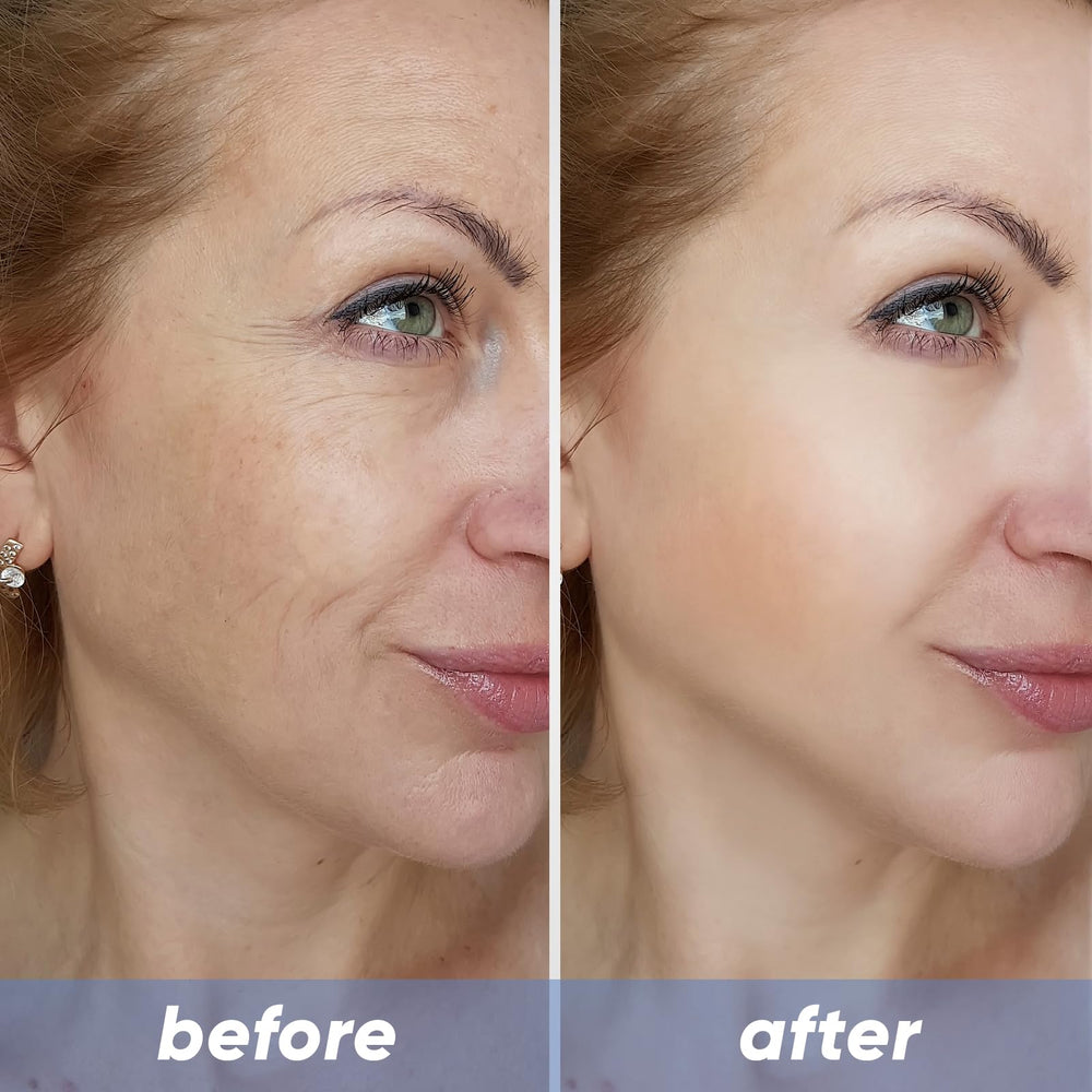 NOVIQO hydrating serum bottle close-up showing deep hydration potential.
