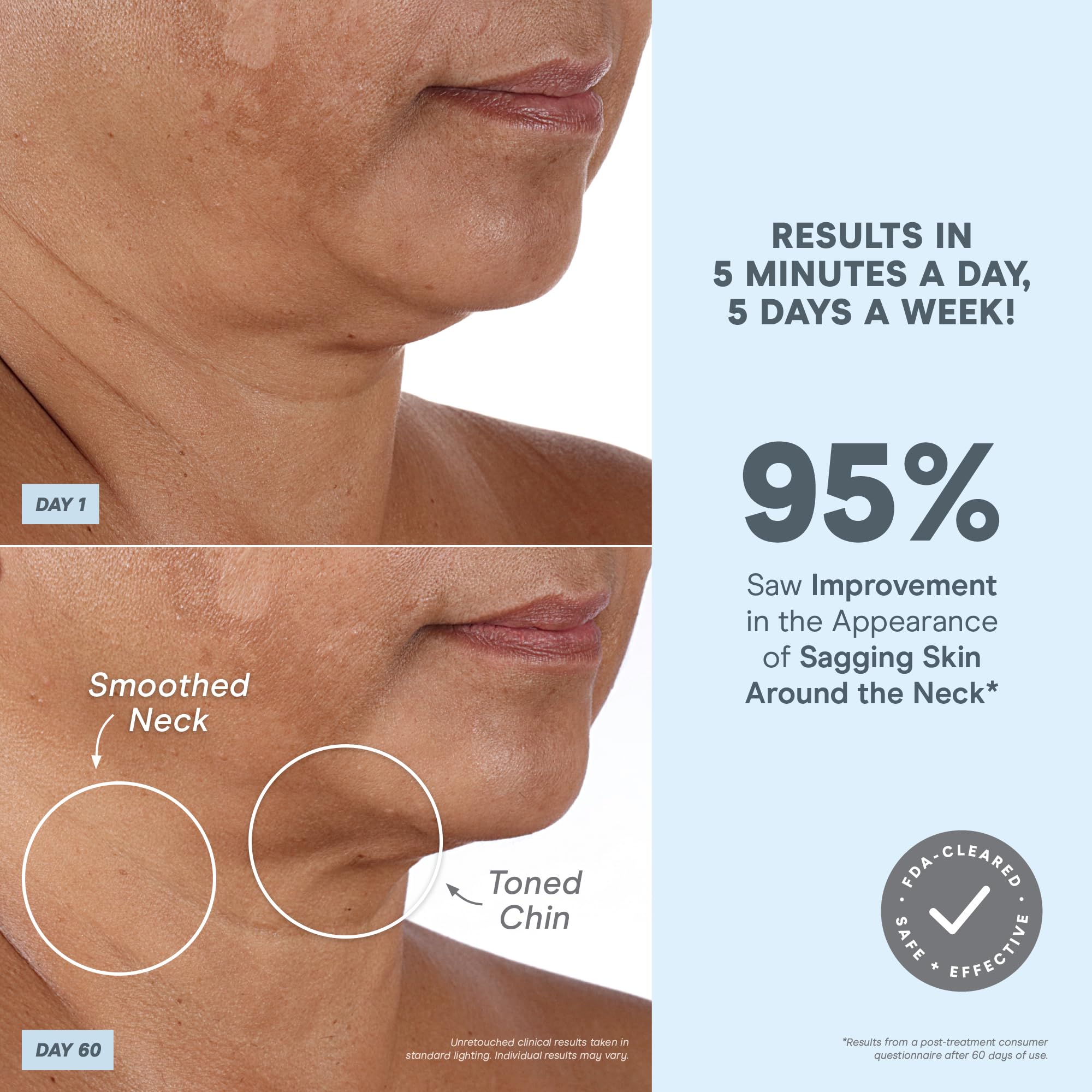 NuFACE MINI+ FDA-cleared status ensures safety and clinician-backed confidence.